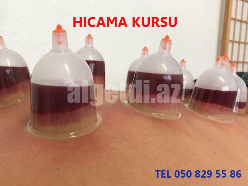 Hicama zəliterapiya kurslari
